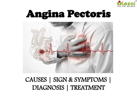 angina pectoris pictures